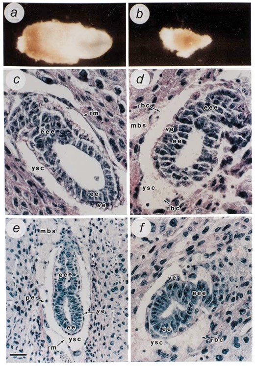 Localization of dystroglycan protein in egg cylinder stage embryos. Sections taken from E6.5 normal (A, B and C) and abnormal (D, E and F) littermates were processed for immunofluorescence with a specific anti-dystroglycan antibody as described in Materials and Methods. (A and D) Low magnification images of the uterine section showing dystroglycan staining in the maternal decidual cells. The edge of the uterine section extends beyond the edge of the field shown on all sides. (B) Higher magnification of (A), and (C), another embryo, show the detailed dystroglycan staining in the normal embryos and associated extraembryonic membranes. Dystroglycan staining is prominently localized in apposition to Reichert's membrane (Rm) and the basement membrane between the visceral endoderm and ectoderm (*). There is fainter staining surrounding most of the other cells in the embryo. Also, staining in the maternal decidual cells (md) can be seen in these higher magnification images. (E) Higher magnification of (D), and (F), another embryo, show dystroglycan staining of typical abnormal embryos. Autofluorescent maternal red blood cells (rbc) can be seen in the yolk sac cavity. There is a complete absence of dystroglycan staining in these embryos, demonstrating that these are Dag1-null embryos. The approximate positions where prominent dystroglycan staining should be are indicated by arrows. Scale bars: A and D, 200 µm; B, C, E and F, 50 µm.