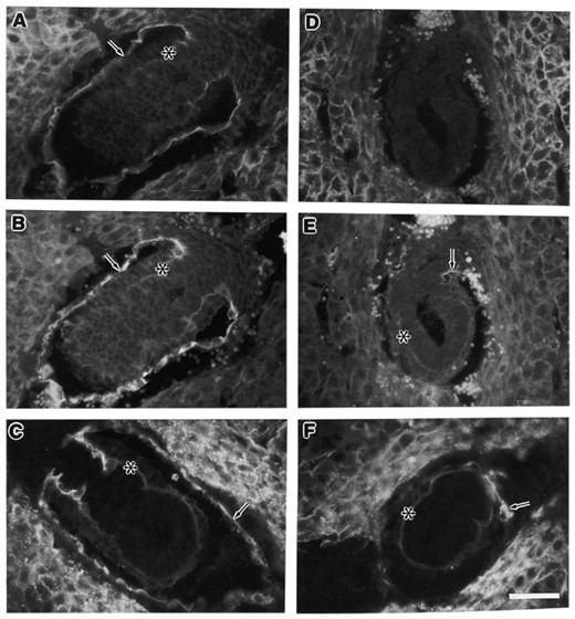 Analysis of Reichert's membrane structural proteins in Dag1-null embryos. Immunofluorescence analysis of dystroglycan (A and D), laminin (B and E) and collagen IV (C and F) expression in a control littermate (A-C) and a Dag1-null (D-F) embryo. E6.5 littermates were stained with the appropriate antibodies as described in Materials and Methods. (A and B) and (D and E) are paired images from embryos simultaneously stained for dystroglycan and laminin. (C and F) Adjacent sections to the ones shown in (A and B) and (D and E), respectively. Note that the embryo shown in (D-F) is the same one shown in Figure 5D and E. In normal embryos, dystroglycan is colocalized with laminin and collagen IV in Reichert's membrane (arrows) and in the basement membrane between the visceral endoderm and ectoderm (*). However in the Dag-1 null embryos, the normally continuous Reichert's membrane staining is reduced to ‘patches’ (arrows), but the staining between the visceral endoderm and ectoderm (*) is still present in these mutants. Scale bar: A-F, 50 µm.