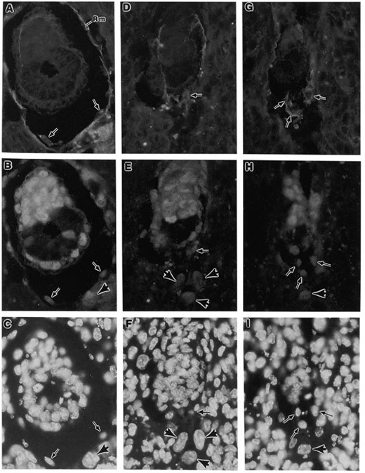 Parietal endoderm cells are present in Dag1-null embryos. Double-label immunofluorescence analysis of laminin (A, D and G), Pem (B, E and H) and nuclear counterstaining (C, F and I) in a control littermate (A-C) and two different sections from a Dag-l-null embryo (D-I). E5.5 littermates from heterozygous intercrosses were sectioned, and the status of dystroglycan expression in the embryos was determined by staining with an anti-dystroglycan antibody. Separate saggital sections were simultaneously stained for laminin and Pem and nuclei were counterstained with 4′,6-diamidino-2-phenylindole. Pem marks the nuclei of a variety of extraembryonic cells, including parietal endoderm cells (arrows) which co-label with laminin. Parietal endoderm cells are clearly present in the Dag1-null embryo. The section shown in (D-F) is a comparable plane to (A-C) and is through the center of the embryo. (G-I) A more tangential section from the same embryo in (D-F). Arrowheads denote trophoblast giant cells. Rm, Reichert's membrane.