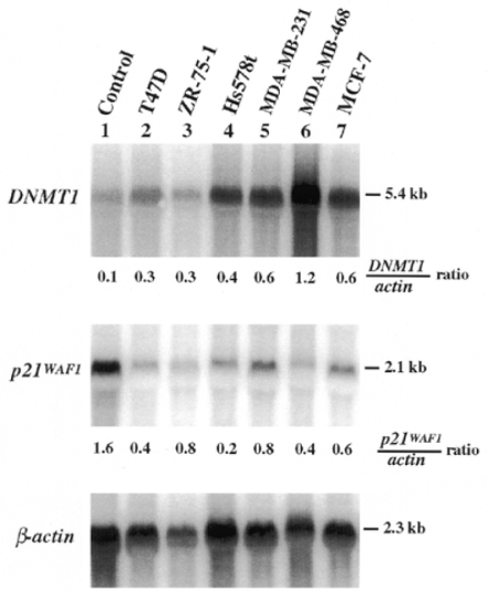 Northern hybridization analysis of DNMT1 and p21WAF1 gene expression in breast cancer cell lines. Total RNA (20 µg) isolated from normal fibroblast (lane 1) and breast cancer cell lines, T47D (lane 2), ZR-75-1 (lane 3), Hs578t (lane 4), MDA-MB-231 (lane 5), MDA-MB-468 (lane 6) and MCF-7 (lane 7), was subjected to northern analysis. The membrane was probed with DNMT1 (top panel), p21WAF1 (middle panel) and β-actin (bottom panel), respectively. The predicted sizes (kb) of the indicated transcripts were calculated using the RNA MW I ladder (Boehringer Mannheim) as a standard. Band intensities were quantified with ImageQuant Software (Molecular Dynamics) and the relative levels of DNMT1 and p21WAF1 mRNAs were normalized with the expression level of β-actin in each sample lane.