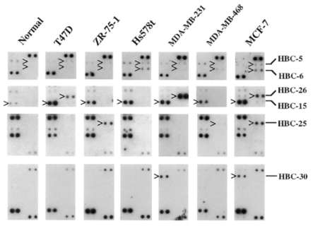 Identification of hypermethylated CpG island loci by differential methylation hybridization. PCR products of CpG island clones were dotted onto membranes in duplicate and probed with the MseI-BstUI-pre-treated amplicons for the normal control and breast cancer cell lines as indicated. Probes were prepared as described in the text. Clones shown on the right (also marked by <) containing hypermethylated BstUI sites were identified on the autoradiogram showing greater hybridization signal intensities of dots hybridized with probes prepared from the breast cancer cell lines than the same dots probed with the normal breast control.