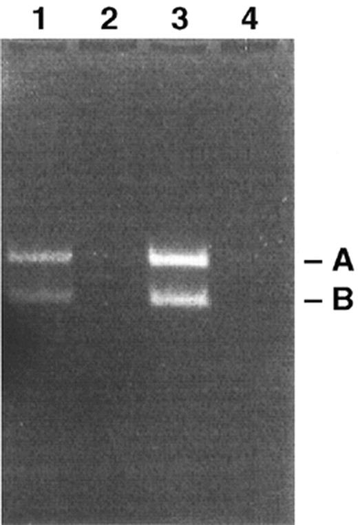 Figure 3. RT–PCR analysis of DISC1 in human fetal brain using the distal primer pair (Table 1). Position 2295, at which the 66 bp deletion starts, corresponds approximately to a splice donor site within the cDNA (AGgtattg instead of the consensus AGgtaagt). Position 2360, where the deletion ends, is known to be a splice donor (J.K. Millar, S. Christie, D. Lawson, D. Hsiao-Wei Loh, B. Arveiler and D.J. Porteus, manuscript in preparation). A product of 270 bp indicates upstream donor site usage. A product of 336 bp indicates downstream donor site usage. Lane 1, 8.3 weeks; lane 2, 10.3 weeks. Arrows indicate the 336 and 270 bp alternatively spliced products (A and B, respectively).