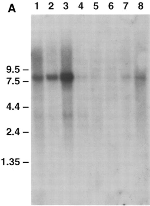 Figure 4. Clontech human multiple tissue northern blots probed with DISC1 (nucleotides 958–1983) and DISC2 (nucleotides 8488–9300). Each lane contains ~2 µg of poly(A)+ RNA. Positions of size markers are indicated. (a) Adult human multiple tissue northern probed with DISC1. Lanes 1–8: heart, brain, placenta, lung, liver, skeletal muscle, kidney and pancreas. (b) Adult human brain multiple tissue northern probed with DISC1. Lanes 1–8: amygdala, caudate nucleus, corpus callosum, hippocampus, whole brain, substantia nigra, subthalamic nucleus and thalamus. An additional filter with RNA from cerebellum, cerebral cortex, medulla, spinal cord, occipital pole, frontal lobe, temporal lobe and putamen was probed and produced similar results (data not shown). (c) Adult human multiple tissue northern probed with DISC2. Lanes 1–8: heart, brain, placenta, lung, liver, skeletal muscle, kidney and pancreas. All four heart transcripts are apparently derived from DISC2 because no other sites in the human genome to which DISC2-derived sequences hybridize have been detected (data not shown).