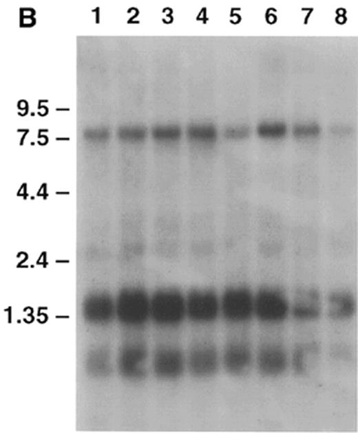 Figure 4. Clontech human multiple tissue northern blots probed with DISC1 (nucleotides 958–1983) and DISC2 (nucleotides 8488–9300). Each lane contains ~2 µg of poly(A)+ RNA. Positions of size markers are indicated. (a) Adult human multiple tissue northern probed with DISC1. Lanes 1–8: heart, brain, placenta, lung, liver, skeletal muscle, kidney and pancreas. (b) Adult human brain multiple tissue northern probed with DISC1. Lanes 1–8: amygdala, caudate nucleus, corpus callosum, hippocampus, whole brain, substantia nigra, subthalamic nucleus and thalamus. An additional filter with RNA from cerebellum, cerebral cortex, medulla, spinal cord, occipital pole, frontal lobe, temporal lobe and putamen was probed and produced similar results (data not shown). (c) Adult human multiple tissue northern probed with DISC2. Lanes 1–8: heart, brain, placenta, lung, liver, skeletal muscle, kidney and pancreas. All four heart transcripts are apparently derived from DISC2 because no other sites in the human genome to which DISC2-derived sequences hybridize have been detected (data not shown).