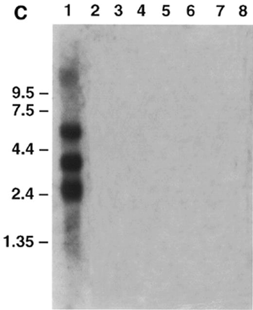 Figure 4. Clontech human multiple tissue northern blots probed with DISC1 (nucleotides 958–1983) and DISC2 (nucleotides 8488–9300). Each lane contains ~2 µg of poly(A)+ RNA. Positions of size markers are indicated. (a) Adult human multiple tissue northern probed with DISC1. Lanes 1–8: heart, brain, placenta, lung, liver, skeletal muscle, kidney and pancreas. (b) Adult human brain multiple tissue northern probed with DISC1. Lanes 1–8: amygdala, caudate nucleus, corpus callosum, hippocampus, whole brain, substantia nigra, subthalamic nucleus and thalamus. An additional filter with RNA from cerebellum, cerebral cortex, medulla, spinal cord, occipital pole, frontal lobe, temporal lobe and putamen was probed and produced similar results (data not shown). (c) Adult human multiple tissue northern probed with DISC2. Lanes 1–8: heart, brain, placenta, lung, liver, skeletal muscle, kidney and pancreas. All four heart transcripts are apparently derived from DISC2 because no other sites in the human genome to which DISC2-derived sequences hybridize have been detected (data not shown).