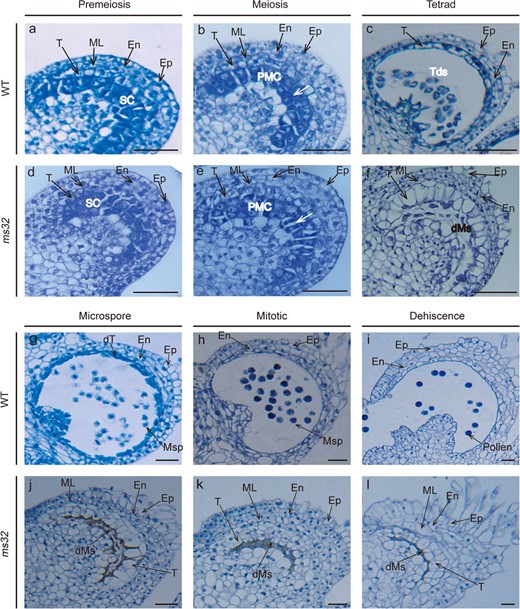 Transverse sections of WT (a–c, g–i) and ms32 (d–f, j–l) anthers at different developmental stages. a, d Premeiotic stage; b, e Meiotic stage, with white arrows pointing to the crushed and separated PMCs; c, f Tetrad stage; g, j Microspore stage; h, k Mitotic stage; i, l Dehiscence stage. dMs, degenerated meiocytes; dT, degenerated tapetum; En, endothecium; Ep, epidermis; ML, middle cell layer; Msp, microspore; PMC, pollen mother cell; SC, sporogenous cell; T, tapetum; Tds, tetrads. Scale bars, 50 μm
