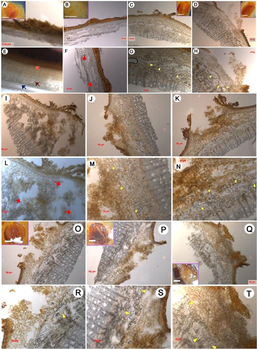 Each lenticel was observed under a stereomicroscope at 0 h (a, e), 72 h (b–d, f–h), 120 h (i–n), and 168 h (o–t). The treatments are as follows: control (a, e, c, g, j, m, p, s), NPA (b, f, i, l, o, r), and IAA (d, h, k, n, q, t). Scale bars, 50 μm. Inset scale bars, a–d = o–q = 0.5 mm. Arrows: yellow, proliferated founder cells; pink, epidermis; brown, parenchyma cells located in the interfascicular cambium; dark blue, vascular tissues; red, cavities.