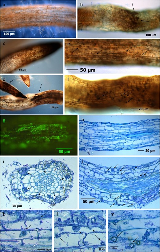 Symptoms were detected after eight weeks of cultivation in RRD soil from the site Heidgraben (H) in whole-mount samples (a–g) and thin sections stained with toluidine blue (f–m). a Healthy fine root with intact root hair zone; b constricted root structure and brown necrotic zones with black cell clusters (arrows) in a toluidine blue-stained root segment; c, d black root tips and clusters (arrows) of necrotic rhizodermal and cortical cells; e fine root with intracellular cauliflower-like (CF) fungal structures (arrows) in necrotic rhizodermal and cortex cells; f CF structures and black cell inclusions (arrows); g green fluorescent Actinobacteria in cortex cells after FUN®1 cell vital staining. h Longitudinal thin section through healthy fine root tissues with rhizodermis R, cortex C, endodermis E, stele St, and xylem X; i cross section of an infected fine root with fungal hyphae and CF structures (arrows) in necrotic cortex cells; j infected fine root with fungal CF structures and hyphae (arrows) in rhizodermal and cortical cells; k thick fungal hyphae, intercellular entry point and developing intracellular CF structure (black arrows) and Actinobacteria (white arrows); l mixed infection with a CF structure-forming fungus (black arrows), rod-shaped bacteria, and thread-like Actinobacteria (white arrows); m cortex cells with fungal CF structures and round-shaped fungal chlamydospores (arrows)