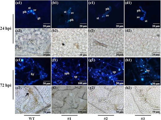 a–d and e–f represent 24 hpi and 72 hpi, respectively. a1–h1 show infected stomata stained with aniline blue under epifluorescence UV-microscopy. a2–h2 show the tissues stained with DAB under bright-field illumination in the field of vision corresponding to (a1–h1). Arrowhead, H2O2 accumulation; gt germ tube, st stomata, sv substomatal vesicle, ph primary hyphae, hy hyphae, sph sporangiophores, sp sporangia