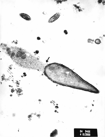 Electron micrograph of spermatozoa from case 4. The arrow shows the finely granular material in the area of the connecting piece and the beginning of the midpiece. Scale bar = 1 μm.