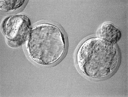 Figure 2. Blastocysts developed from germinal vesicle transplanted (GVT) oocytes 96 h after ICSI. Note hatching from the slit on the zona made during GVT (original magnification 400×).