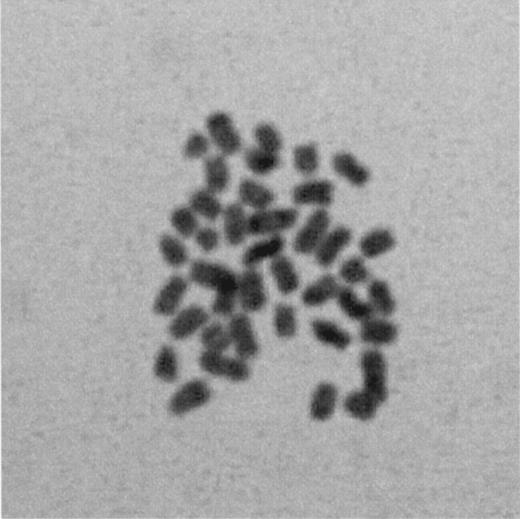 Figure 3. Metaphase diploid chromosomes observed in a blastomere isolated from a 2‐cell stage embryo (original magnification 600×).
