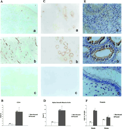 Immunolocalizations of CD34 (A), α-SMA (C) and prolactin (E) in the peri-implantation phase endometria from non-fecund (a) and fecund (b) bonnet monkeys. Respective negative controls are shown in (c). Semiquantitative comparisons of immunoreactive CD34 (B), α-SMA (D) and prolactin (F) in endometria from fecund and non-fecund animals are shown lower panels (*P<0.05).