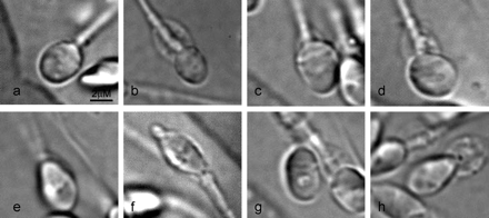 Micrograph of spermatozoa obtained by the strict and compromised selection methods: (a) sperm cell with a morphologically normal nucleus; (b) small oval nuclear form; (c) large oval nuclear form; (d) wide nuclear form; (e) narrow nuclear form; (f) regional (acrosomal) nuclear shape disorder; (g) oval nuclear shape + large nuclear vacuoles; (h) abnormal (narrow) nuclear shape + large nuclear vacuoles.