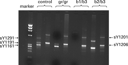 Multiplex PCR for molecular diagnosis of partial AZFc deletions with primers sY1291, sY1191, sY1161, sY1206 and sY1201. Examples of migration patterns on a 2% agarose gel of a normal sample and samples with gr/gr (sY1291 missing), b1/b3 (sY1291, sY1191 and sY1161 missing) and b2/b3 (sY1191 missing) deletions.