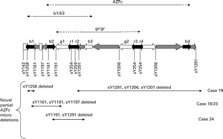 Illustration of the region of the Y chromosome indicating the segments deleted in the case of AZFc, gr/gr and b1/b3 deletion. The novel deletions found in this study remove the sY markers indicated below the Y chromosome structure. The exact extension and location of the novel deletions, however, were not detemined in this study and are indicated arbitrarily.