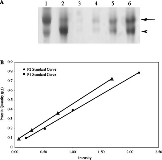 (A) Acid gel electrophoresis of purified P1 (arrow) and P2 (arrowhead) proteins. Shown are representative banding patterns for a patient with a high P1/P2 ratio (lane 1), a low P1/P2 ratio (lane 2), and four human protamine standards used to generate standard curves (lane 3: 0.1895 μg; lane 4: 0.3789 μg; lane 5: 0.7578 μg; lane 6: 1.5156 μg). (B) Representative standard curves used to calculate P1 and P2 quantity. Linear regression resolved a P2 standard curve fitting the equation [P2]=0.3919(Intensity)+0.066 with an R2 value of 0.9999. The P1 standard curve fit the equation [P1]=0.3547(Intensity)+0.0259 with an R2 value of 0.9988.
