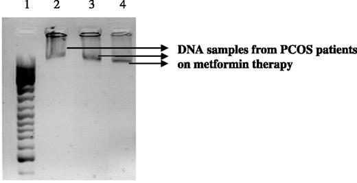 Agarose gel electrophoresis [2% agarose gel containing ethidium bromide (0.5 mg/ml) in TAE buffer] of genomic DNA extracted from granulosa cells obtained from PCOS patients on metformin therapy. Lane 1: DNA ladder from 50 to 1031 bp. Lanes 2, 3 and 4: genomic DNA samples from PCOS patients on metformin therapy.