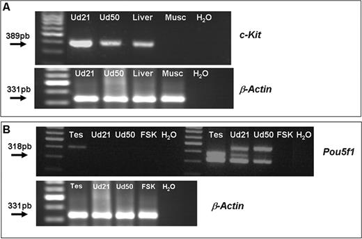 PCR and nested-PCR analysis for c-Kit and Pou5f1 in the murine uterus. (A) Upper panel: PCR shows a 389-bp band corresponding to c-Kit product. Lower panel: the expression of the housekeeping gene β-Actin is shown. (B) Upper panel: nested-PCR for Pou5f1 in the murine uterus. A band corresponding to 318 bp appears when a second round of PCR was performed using the product of the first amplification. Lower panel: housekeeping expression is shown. All bands obtained by PCR and nested-PCR were confirmed by sequentiation analysis. Lanes: Ud21, murine uterus at day 21; Ud50, murine uterus at day 50. Liver corresponds to murine liver as positive control; Musc, human skeletal muscle as negative control; tes, murine testis as positive control; FSK, human foreskin as negative control.