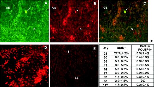 Co-localization of 5-bromo-2′-deoxyuridine (BrdU) cells with the undifferentiation marker POU5F1 in the mouse endometrium. (A) Arrow indicates green BrdU-labelled cells in the stromal endometrium at day 49. (B) POU5F1+ cells (red staining) can be visualized in the same section as (A). (C) Arrow indicates the double-labelled cells (BrdU+/POU5F1+) in the murine endometrium. (D) A human embryonic stem cell line (VAL-1) was used as positive control, and (E) mouse endometrium with the deletion of the first antibody was used as negative control. (F) The percentage of BrdU-retaining cells, and BrdU-retaining cells co-localized with POU5F1 during mouse life. GE, glandular epithelium; LE, luminal epithelium; PA, hepatic portal area; S, stroma. All panels are ×400 magnification.