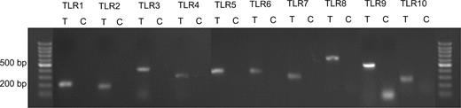 The expression of Toll-like receptor (TLR) 1–10 genes in human endometrial tissue. Each pair of primers produced a specific product with the specific predicted size in the test (T) samples. C = control samples.