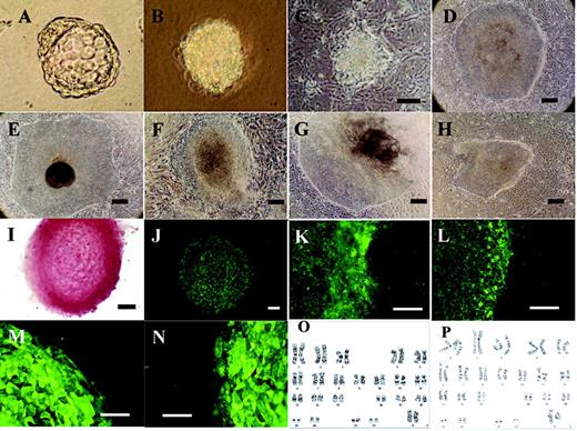 Derivation and characterization of human embryonic stem cell (hESC) lines. Frozen-thawed human embryos were cultured to blastocyst stage, and hESCs were derived as described in Materials and methods. (A) A blastocyst after treatment with proteinase to remove the zona pellucida. (B) The trophoblast cells appeared destroyed after immunosurgery. (C) Seven days after plating the inner cell mass (ICM) on the feeder cells. (D) NTU1 hESC line at passage 4. (E) NTU2 line at passage 7 transferred by mechanical method. This is a morphologically good colony. (F) NTU1 line at passage 11 transferred by collagenase type IV. (G) A morphologically fair colony. (H) A morphologically poor colony. (I–N) These are representative marker expressions for NTU1 line. (I) Alkaline phosphatase. (J) Oct-4. (K) SSEA-3. (L) SSEA-4. (M) TRA-1-60. (N) TRA-1-81. (O) Karyotype of NTU1 line (46, XX). (P) Karyotype of NTU2 line (46, XX). Scale bars, 200 µm.