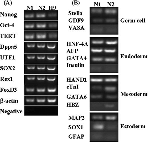 RT–PCR studies of the NTU1 and NTU2 human embryonic stem cell (hESC) lines. The methodology of RT–PCR was described in Materials and methods. (A) Expression of stem cell markers in undifferentiated hESC lines. (B) Expression of markers after in vitro differentiation of hESC lines. N1, NTU1 hESC line. N2, NTU2 hESC line. H9, a published hESC line from Thomson’s group (Thomson et al., 1998).