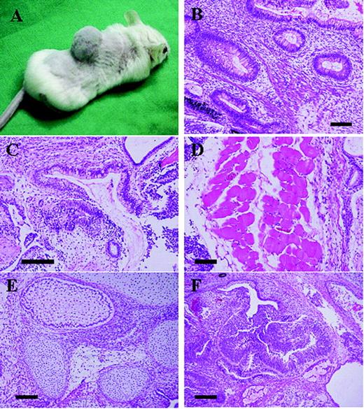 In vivo differentiation of human embryonic stem cell (hESC). Cells were injected s.c. into the back of severe combined immunodeficient (SCID) mice, and teratoma was removed at 8–12 weeks. Pathological examination of identified cells representing all three embryonic germ layers. (A) A tumour in the back of the SCID mouse. (B) Intestinal tract tissue with mucous-containing cells (endoderm) and optic disc-like structure with pigmented epithelium (ectoderm). (C) Respiratory tract tissue (endoderm). (D) Skeletal muscle (mesoderm). (E) Cartilage (mesoderm) and tooth (ectoderm). (F) Neural tubule (ectoderm). Scale bars, 100 µm.
