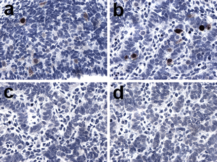 Expression of GAGE in primordial germ cells (PGCs). GAGE was expressed in the PGCs of the gonadal primordium of 6-(a) and 8-week-old (b) embryos. MAGE-A1 (c) and NY-ESO-1 (d) were not detected in the embryonal gonad. No staining was observed using the negative control antibody (Magnification: × 40).