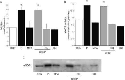 DRSP increases NO synthesis and eNOS activity and expression via progesterone receptor Steroid-deprived HUVECs were treated for 48 h with P (10−7 M), MPA (10−7 M) or DRSP (10−7 M), either alone or in the presence of the PR antagonist RU486 (RU486, 10−5 M). (A) NO synthesis was assayed; (B) eNOS activity was tested and (C) shows eNOS protein amounts. *P < 0.01 versus control