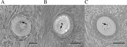Follicle identification. (A) Primordial, bar = 20 µm; (B) intermediate, bar = 20 µm; (C) primary, bar = 40 µm. Tissue section thickness is 25 µm. The arrow in each photomicrograph identifies the nucleolus, which must be in sharp focus in the optical disector counting volume for a follicle to be counted