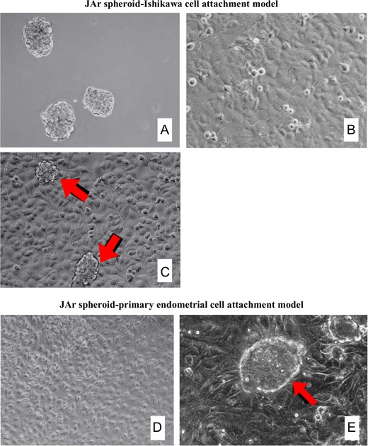 Co-culture of JAr spheroids and epithelial cell monolayer. (A) JAr spheroids with a size range of 100–150 μm was generated by shaking at 106 rpm for 18 h. (B) Ishikawa epithelial monolayer after 3–5 days of culture. (C) JAr spheroids attached firmly onto Ishikawa epithelial monolayer (arrow). (D) Human primary endometrial epithelial cell monolayer after culture to confluence. (E) JAr spheroids attached firmly onto primary endometrial cell monolayer (arrow). Magnification 100× (A–D), 200× (E).