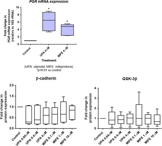 Effect of ulipristal acetate (UPA) and mifepristone (MIFE) on progesterone receptor expression (upper panel) and the Wnt/β-catenin signal transduction pathway (lower panels) in JAr cells. JAr cells were treated with either UPA or MIFE at the respective doses for 24 h. The progesterone receptor mRNA expression was determined by real-time reverse transcription and polymerase chain reaction, and was significantly increased (P < 0.05) upon treatment with UPA and MIFE compared to control. The expression levels of β-catenin and GSK-3β were detected by Western blotting and quantified by ImageJ software. The box-whisker plots showed no significant changes (P > 0.05) in these molecules in all treatment conditions (the boxes show the median and the 25th and 75th percentiles, whereas the whiskers show the minimum and maximum). The experiments were repeated five times.