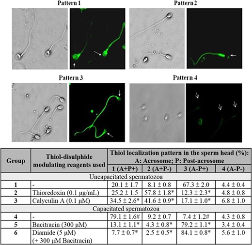 Localization of cell surface thiol on human spermatozoa. Sperm surface thiols were biotinylated with MPB. They were then visualized using streptavidin-FITC. The results shown are representative of five replicate experiments. Lower: Quantification of MPB-labelled spermatozoa with different staining patterns. Data represent the mean ± SEM (N = 5). #P < 0.05 when compared between uncapacitated (Group 1) and capacitated spermatozoa without treatment (Group 4). *P < 0.05 when compared with the corresponding control (Group 1 or Group 4) without treatment.