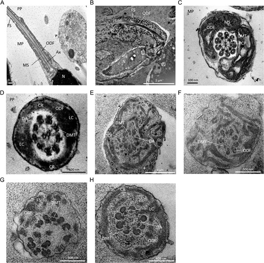 Transmission electron microscopy analyses of sperm cells from a control subject (A, C, D) and patient FSIP2_4 (B, E–H). (A) Longitudinal sections of sperm flagellum from control. In the midpiece (MP), outer dense fibers (ODF) are found longitudinally between the mitochondrial sheath (MS) and the axoneme (Ax). The fibrous sheath (FS) is found in the principal piece (PP). N, nucleus. (B) Longitudinal sections of sperm flagellum from patient FSIP2_4. We notice an abnormal flagellum with the FS which appears severly disorganized and extends up to the sperm neck. ODFs remains present whereas the MS is totally absent from the midpiece likely due to an abnormal migration of the annulus. The central axoneme is not clearly visible. (C) Cross-sections of the MP in a control. The axoneme is surrounded by nine ODFs and the MS. The axoneme is composed of nine peripheral microtubules doublets (DMTs) and a central pair (CP) of singlet microtubules. (D) Cross-sections of the PP from a fertile control. The axoneme is surrounded by seven ODFs and by the FS composed of two longitudinal columns (LC) connected by circumferential ribs (CR). DA, dynein arms. (E–H) Cross-sections of sperm flagellum from patient FSIP2_4. The FS is dysplastic, thickened and dramatically disorganized with randomly oriented fibers (E–G). When the CR seem present, we observed only one nascent and abnormal LC adjacent to doublets 3 or 8 (H). Various axonemal anomalies can be observed including the lack of the CP (E, F, H) or complete axonemal desorganization (G). Alterations of ODFs is also seen with surpernumeray (E), missing (F) or fully disorganized ODFs (G). DA are rarely visible (E, H).