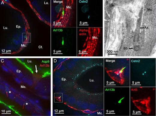 Primary cilia extend from basal and peritubular myoid cells in the epididymis of adult mice. Immunofluorescent staining for alpha-actin myoid cell marker (A and inset), aquaporin 9 (Aqp9) principal cell marker (C), keratin-5 (Krt5) basal cell marker (D and inset) was performed on epididymal sections from adult Arl13b-Cetn2 dTg mice. Primary cilia organelles were exclusively found associated with basal cells (stars) and myoid cells in these tissues. Arrow indicates Aqp9-negative clear cell. Primary cilia structural components, such as the axoneme and basal body, were detected by transmission electron microscopy in epididymal peritubular myoid cells from C57BL/6 mice (B). Ax.: axoneme; Bb.: basal body; Ct.: connective tissue; Ep.: epithelium; Lu.: lumen; Mc.: myoid cells.