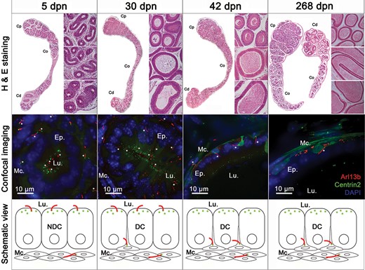 Primary cilia (PC) are observed at different stages of postnatal epididymal development. Hematoxylin and eosin staining (H & E) and confocal imaging were performed on epididymal sections from Arl13b-Cetn2 dTg mice at different stages of postnatal development, i.e. at 5, 30, 42 and 268 days postnatal (dpn). PC were detected from different epididymal tubules at each stage of postnatal development (stars). Schematic representation of PC location is shown throughout postnatal development with centrioles displayed in green and PC in red. Cp, Co, Cd: caput, corpus, cauda. DC: differentiated cells; NDC: non-differentiated cells; Lu.: lumen; Mc.: myoid cells.