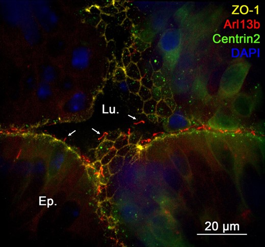 Primary cilia are in contact with the intraluminal compartment of the epididymis at an early stage of postnatal development. Immunofluorescent staining for the tight junction protein-1 (ZO-1) was performed in the cauda epididymidis of Arl13b-Cetn2 dTg mice at 5 days postnatal (dpn). Primary cilia extend from the apical pole of the cells towards the intraluminal compartment (arrows). Lu.:lumen; Ep.:epithelium.