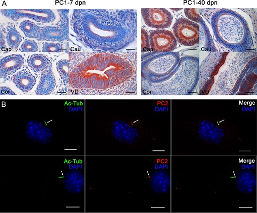 Expression of Polycystin 1 (PC1) and Polycystin 2 (PC2) in epididymal cells and in the mouse epididymis. (A) Immunohistochemical staining for PC1 in the epididymis of Arl13b-Cetn2 dTg mice was performed at 7 and 40 days postnatal (dpn). Cap.: caput; Cor.:corpus; Cau.:cauda; VD: Vas deferens. Scale bars: 50 μm. (B) Immunofluorescent staining for PC2 and the PC marker acetylated tubulin (Ac-Tub) was performed on DC2 cells. PC2 co-localizes with Ac-Tub-positive primary ciliary extension (arrows). Scale bars: 5 μm
