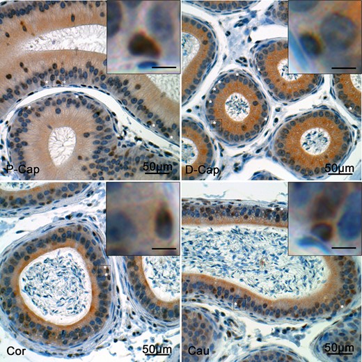 Expression of Gli-3 in the mouse epididymis. Immunohistochemical staining for Gli-3 was performed in the epididymis of Arl13b-Cetn2 dTg mice at 40 days postnatal (dpn). Gli-3 was detected in the basal cell nuclei (stars) from the different epididymal segments. P-Cap: proximal caput; D-Cap: distal caput; Cor.:corpus; Cau.:cauda. Inset scale bars: 10 μm