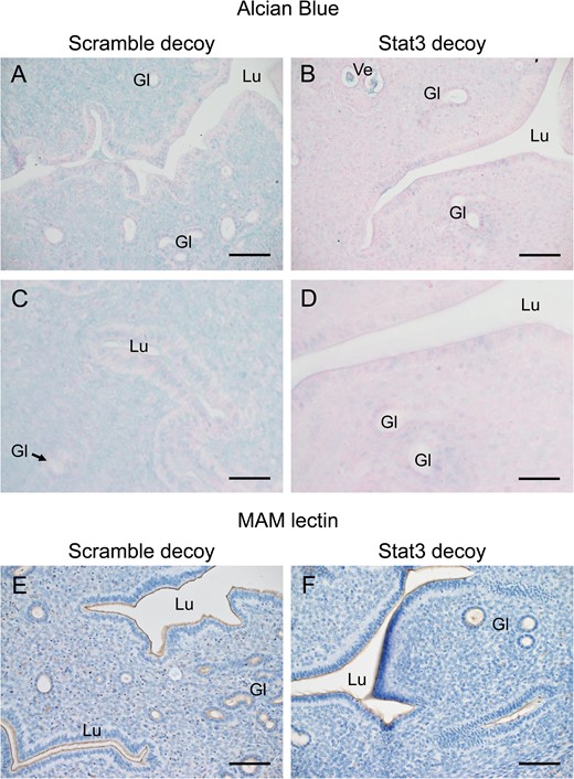 The effect of local suppression of Stat3 activity on sulfated and sialylated uterine glycocalyx. Twenty four hours gene transfection (1 day before implantation began), alcian blue staining with Kernechtrot counterstaining (A–D) and MAM lectin staining with hematoxylin counterstaining (E, F) staining was performed in the uterine tissue with signal transducer and activator of transcription-3 (Stat3) (B, D, F) or scramble (A, C, E) decoy. Lu, lumen; Gl, gland; Ve, blood vessel. Scale bars: (A, B, E, F) 100 μm, (C, D) 50 μm.
