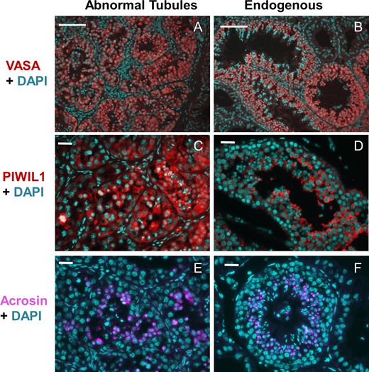 Immunofluorescent staining of the transplanted monkey testis. Markers for germ cells (VASA) (A and B), spermatocytes/spermatids (PIWIL1: (Piwi Like RNA-Mediated Gene Silencing 1)) (C and D) and spermatids (acrosin) (E and F) were used. Note that the germ cells in the abnormal tubules stain positively for all the markers (A, C, and E), as observed in the normal endogenous tubules (B, D and F) and the acrosin staining is localized to the acrosomal cap of spermatids. DAPI was used to counterstain the nuclei. Scale bars: A,B: 100 μm, C–F: 25 μm.