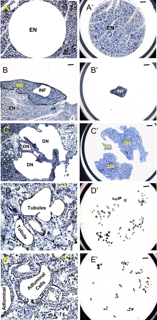 Laser capture microdissection of different regions from tissue sections of the transplanted testis of monkey M1. (A, B, and C) Remaining tissue after dissection. (A′, B′ and C′) Dissected tissues on caps. (D, E) High magnification images showing outlines of representative tubules from which the entire tubule and just the adluminal cells leaving the basal layer, respectively, were dissected away. (D′, E′) Caps showing large number of such tubule portions dissected from multiple regions similar to those shown in D and E. (A, A′) Area containing exclusively EN. (B, B′) Area with INF found in regions of abnormal tubules. (C, C′) Areas with irregular tubules that are suspected to be DN. (D, D′) Dissection of whole tubules (Tubules) containing germ and somatic cells from the abnormal tubular regions. (E, E′) Dissection of the adluminal regions (Adluminal) of these tubules presumably containing only germ cells. Scale bars: A–C, A′–C′, D′, E′: 400 μm; D, E: 50 μm.