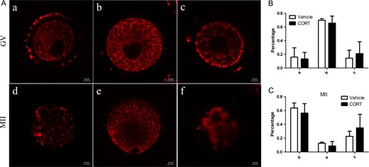 Mitochondrial redistribution in oocytes from corticosterone (CORT)-treated mice. (A) Systematic comparative studies of mitochondrial redistribution in germinal vesicle (GV) and metaphase 2 (MII) oocytes. Mitochondria in GV oocytes showed: a, perinuclear distribution; b, homogenous distribution or c, clustering distribution. In MII oocytes mitochondria showed: d, polarized distribution; e, homogeneous distribution or f, clustering distribution. (B, C) Histograms showing the results of statistical analysis of different types. There was no significant difference compared to vehicle-treated mice (P > 0.05).