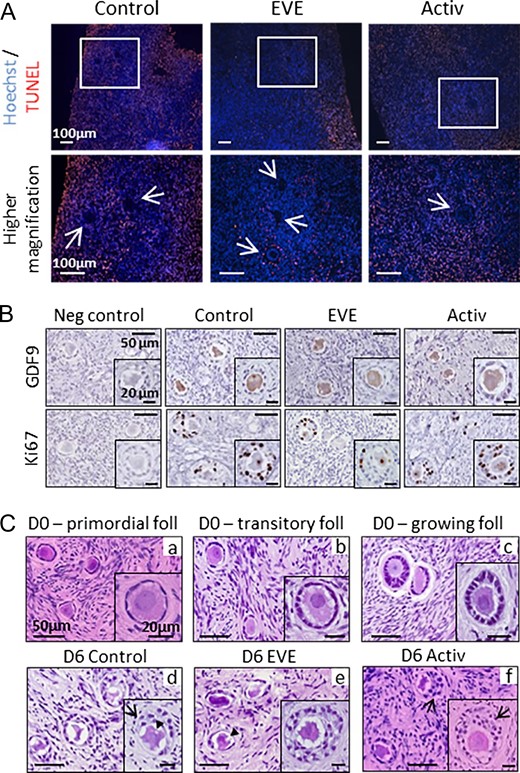 Follicular survival and morphology after treatment exposure and in vitro growth. (A) After 6 days of culture, apoptosis was observed in some stromal cells in all groups but only rarely in in vitro grown follicles. Apoptotic cells were stained by TUNEL (red). Arrows indicate follicles. (B) Oocytes of in vitro grown follicles expressed GDF9, and Ki67 was detected in the granulosa cells of follicles after 6 days of culture. In accordance with the lower rate of growing follicles observed in the EVE group, Ki67 staining was lower in this group compared to control and activator groups. Negative controls (neg control) were unexposed to primary antibodies. (C) The follicular shapes after thawing were well preserved in primordial (a), transitory (b) and growing (c) follicles but secondary follicles displayed morphological abnormalities and presented over-growth patterns after 6 days of culture (d–f), including vacuoles within the oocyte (arrowhead) or anarchic proliferation of the granulosa cells (arrow). Foll = follicle; D0, D6 = Days 0 and 6 of culture, respectively.