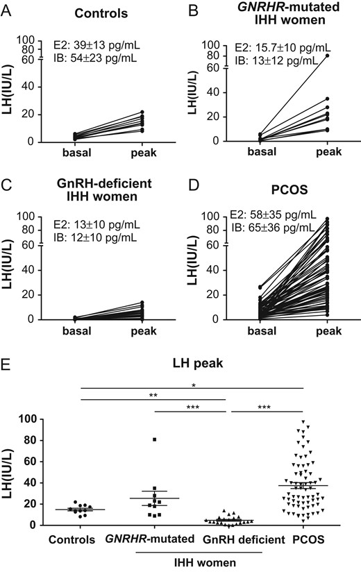Basal and stimulated (peak) serum LH levels in response to a GnRH bolus in different female groups. A: Female healthy control in the early follicular phase (n = 11); B: Female nCHH patients carrying biallelic GNRHR mutations (n = 11); C: Female patients with CHH due to GnRH deficiency (n = 22: Kallmann syndrome n = 12, normosmic hypothalamic CHH n = 10); D: patients with PCOS (n = 70); E: Comparison of stimulated LH values (peaks) in healthy controls (n = 11), GNRHR-mutated patients (n = 11), GnRH-deficient CHH (n = 21) and PCOS patients (n = 70). Horizontal and error bars indicate mean ± SD. E2: serum estradiol levels (mean ± SD); IB: serum inhibin-B levels (mean ± SD). *P < 0.05, **P < 0.01, ***P < 0.001. Kolmogorov–Smirnov non-parametric test.