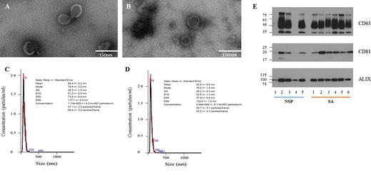 Characterisation of seminal fluid-derived exosomes from different patients. TEM images of exosomes isolated from NSP (A) and SA (B) men; scale bar: 150 nm. Representative NTA plots of exosomes from NSP (C) and SA (D) men. (E) Biochemical characterisation of seminal fluid-derived exosomes: western blot analysis shows the presence of different canonical exosomal markers (CD63, CD81 and ALIX) in NSP and SA populations.