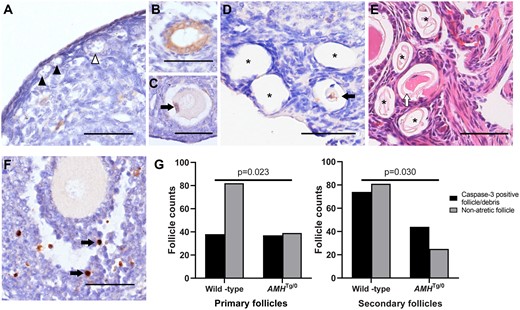 Follicle atresia in AMH-overexpressing (Thy1.2-AMHTg/0) mice. Cleaved (activated) caspase-3 immunoreactivity (brown DAB staining with blue haematoxylin counter stain) was not readily apparent in primordial (black arrowhead) and transitioning (white arrowhead) follicles (A). The cleaved caspase-3 immunostaining was observed in the granulosa cells of primordial follicles (B) and in the granulosa cells (C, black arrow) or oocytes (D, black arrow) of primary/secondary follicles at more-advanced stages of atresia. Numerous primary follicle-sized empty cavities were also observed (D, asterisk) and were shown to contain the remnants of zonae pellucidae via haematoxylin and eosin staining (E, asterisks). Cleaved caspase-3 was commonly found in a small number of granulosa cells (black arrows) in healthy developing follicles, serving as an internal positive control (F). Scale bars: 50 µm. The ratios of non-atretic primary and secondary follicles and similar-sized stromal cavities containing cleaved-caspase-3 positive degenerating oocytes or granulosa cells were assessed by Fisher’s exact test (G), follicle counts were obtained from n = 4 mice per group. AMH, anti-Müllerian hormone; DAB, diaminobenzidine.