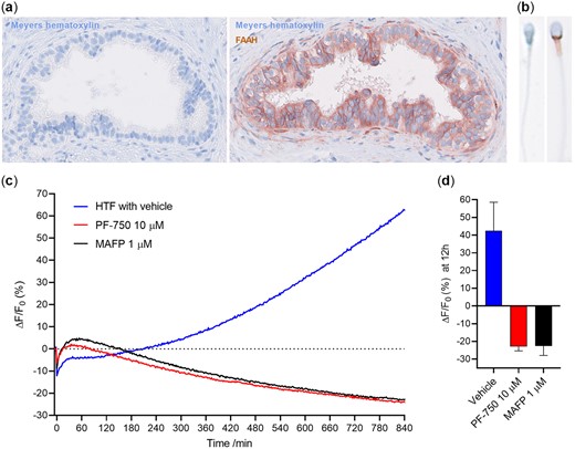 Fatty acid amide hydrolase (FAAH) expression and activity. Human epididymis (×40 magnification) (a) and sperm cells (×80 magnification) (b) have FAAH expression. (c, d) Human sperm cells are capable of hydrolyzing 4-methyl coumarin amide (AAMCA), a fluorogenic substrate for FAAH, with an activity that can be inhibited by both an FAAH specific (PF750) inhibitor and an unspecific inhibitor of membrane serine hydrolases (Methyl arachidonyl fluorophosphonate, MAFP). Data in (c) are representative graphs from a single experiment. Data in (d) are shown after 12 h and values are mean ± SD (n = 3).