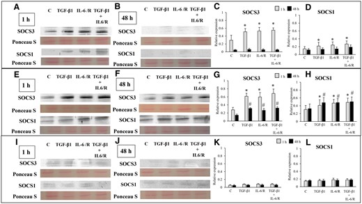 Effects of stimulation by TGF-β1 and/or IL-6/sIL-6R on suppressor of cytokine signaling (SOCS) 3 and SOCS1 protein expression. (A, B, E, F, I, J) Representative photomicrograph of western blot analysis for SOCS3 and SOCS1 in the ESCs-healthy (A, B), ESCs-endo (E, F) and Ectopic-ESCs (I, J) groups. (C, D, G, H, K, L) Relative expression levels of SOCS3 (C, G, K) and SOCS1 (D, H, L) in the ESCs-healthy (C, D), ESCs-endo (G, H), and Ectopic-ESCs (K, L) groups. Signal intensities were normalized to total protein (Ponceau S staining). C, control (vehicle alone: PBS); Ectopic-ESCs, endometriotic stromal cells; ESCs, endometrial stromal cells; ESCs-endo, ESCs from patients with endometriosis; ESCs-healthy, ESCs from healthy women; IL-6/R, IL-6/soluable IL-6 receptor. ESCs-healthy: n = 6. ESCs-endo: n = 8. Ectopic-ESCs: n = 8. Numerical values are presented as the mean ± SD. *P < 0.05: versus Control at 1 h. #P < 0.05: versus Control at 48 h.